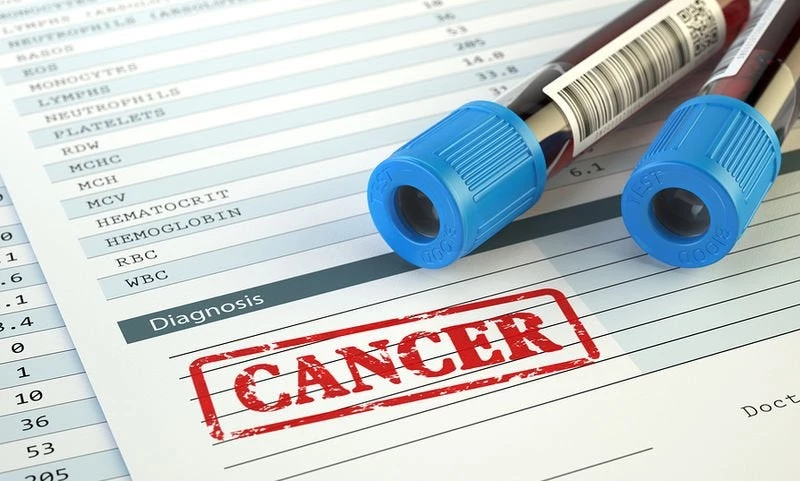 Ελπίδες για θεραπεία της λευχαιμίας – Έλληνες επιστήμονες βρήκαν ουσία που την καταπολεμά